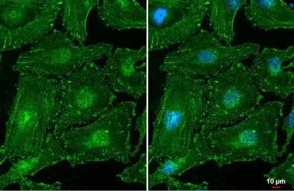 Alpha Actinin 2 Antibody