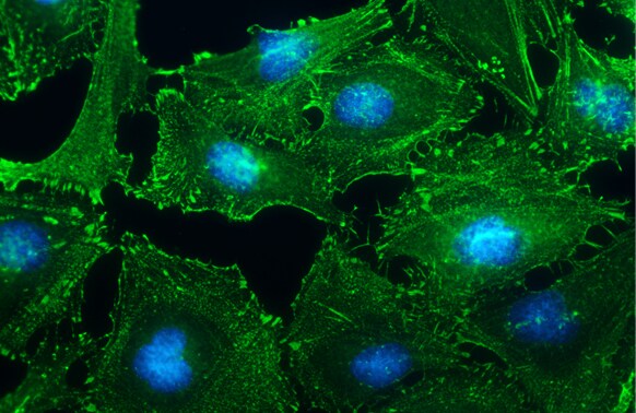 Alpha Actinin 2 Antibody