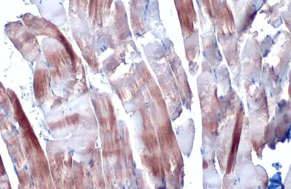 Alpha Actinin 2 Antibody