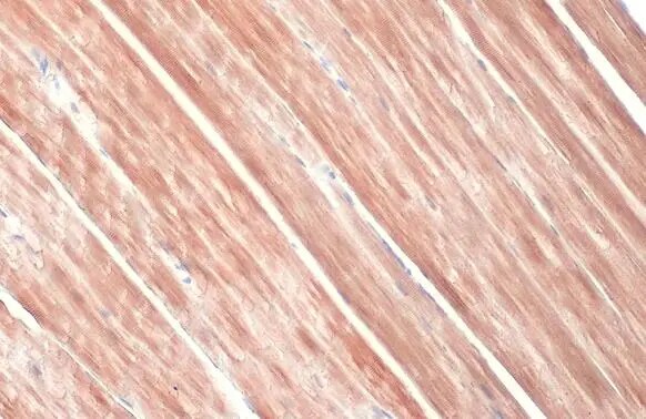 Alpha Actinin 2 Antibody