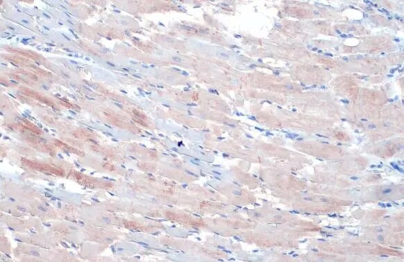 Alpha Actinin 2 Antibody