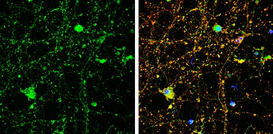 Amphiphysin/AMPH Antibody