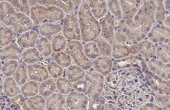 MLYCD Antibody - Azide and BSA Free