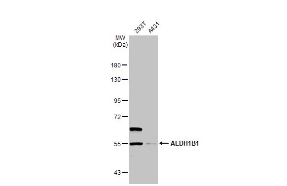 Aldehyde dehydrogenase 5 Antibody