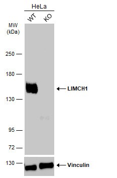 LIMCH1 Antibody