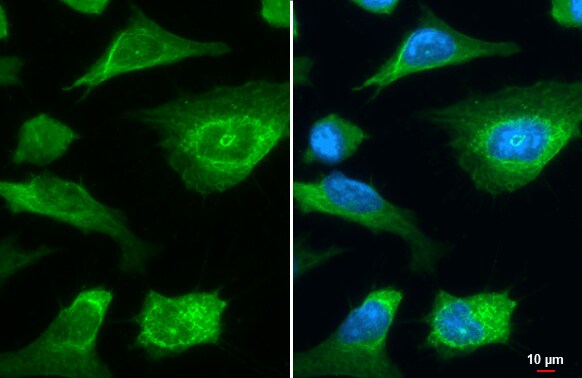 LIMCH1 Antibody