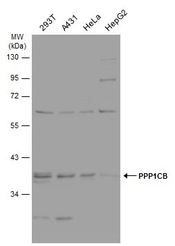 Protein Phosphatase 1 beta Antibody