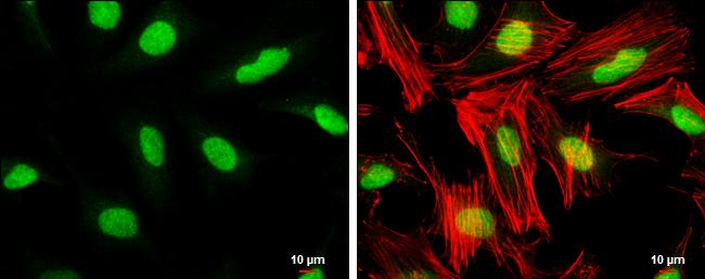 TFIIB Antibody - BSA Free