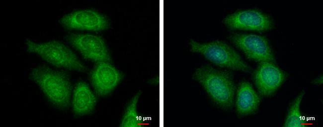 FASTKD1 Antibody - BSA Free