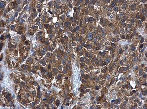 Glutathione S-transferase Mu 5 Antibody