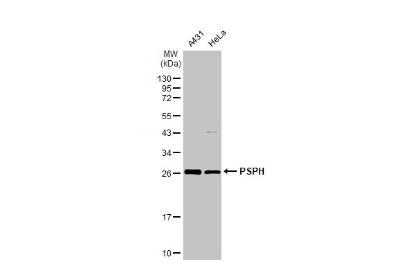 PSPHL Antibody