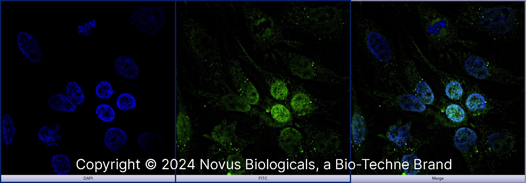 Arginase 1/ARG1/liver Arginase Antibody [FITC]
