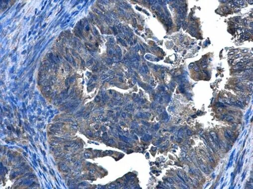 CCDC83 Antibody