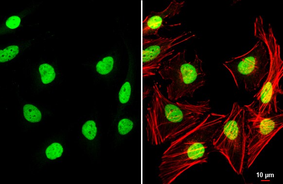 TEAD4 Antibody