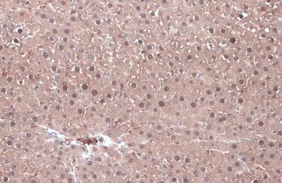 Ketohexokinase Antibody