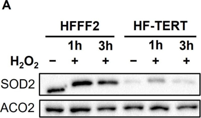 Aconitase 2 Antibody - BSA Free