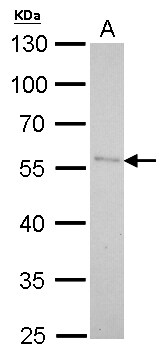 Pancreatic Lipase Antibody