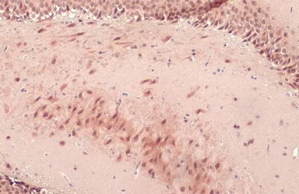 O-GlcNAc Transferase p110 subunit Antibody