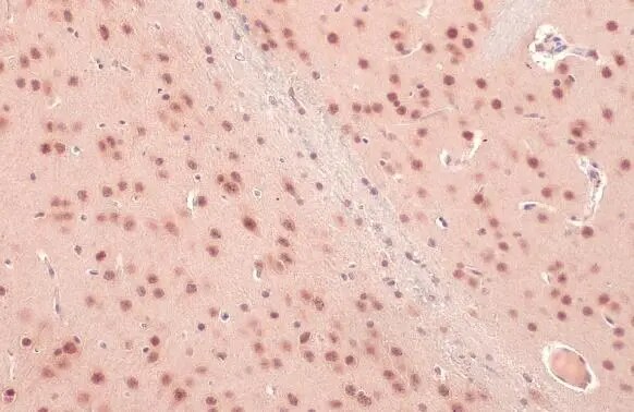 O-GlcNAc Transferase p110 subunit Antibody