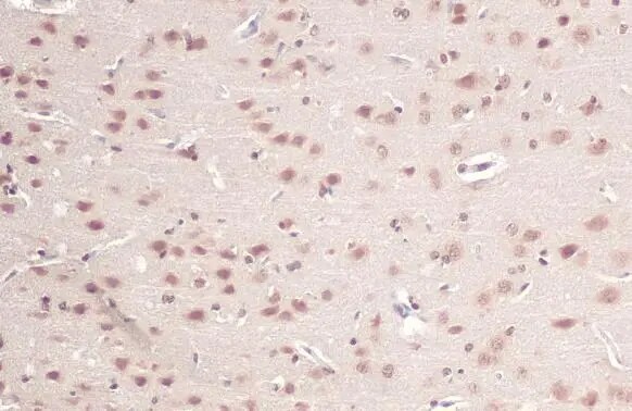 O-GlcNAc Transferase p110 subunit Antibody