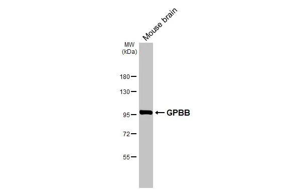 Glycogen Phosphorylase BB/GPBB Antibody
