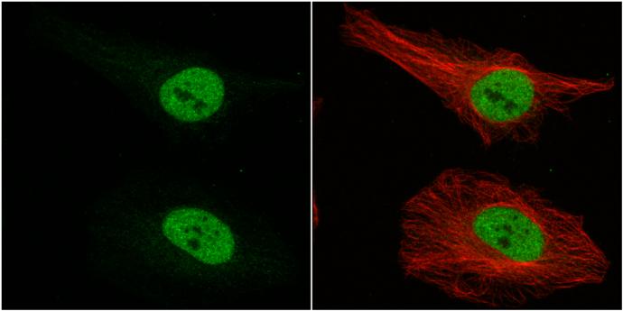 Musashi-1 Antibody - BSA Free