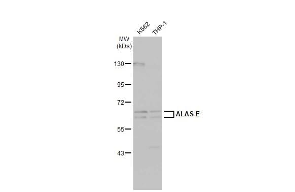ALAS2 Antibody - BSA Free