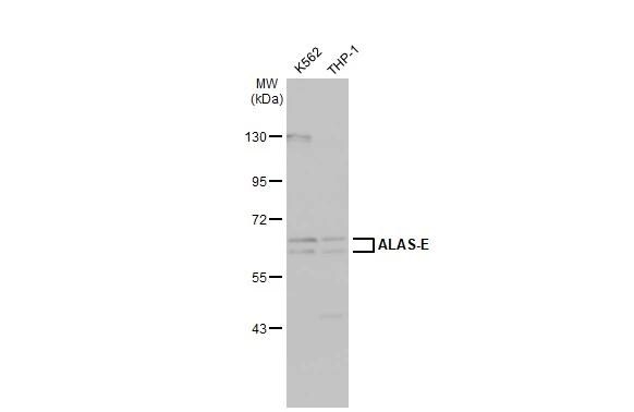 ALAS2 Antibody - BSA Free