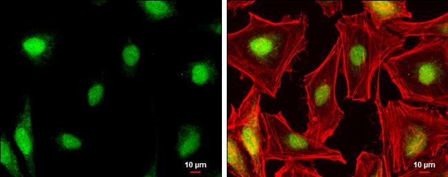 DAX1/NR0B1 Antibody - BSA Free