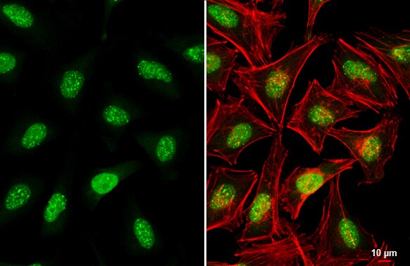 ATRX Antibody