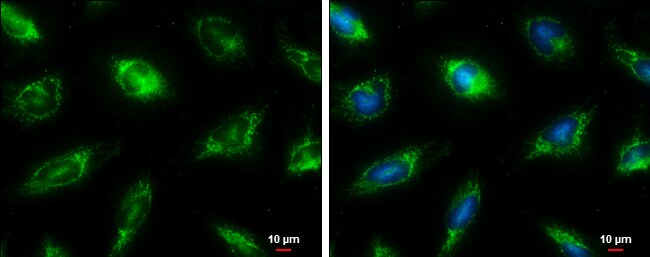 Fumarase Antibody