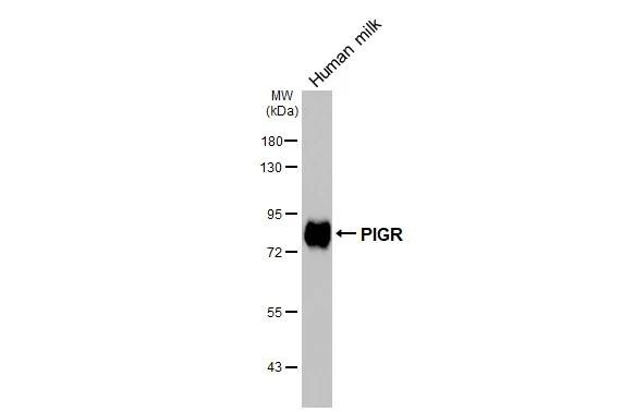 pIgR Antibody