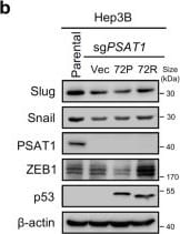 PSAT1 Antibody