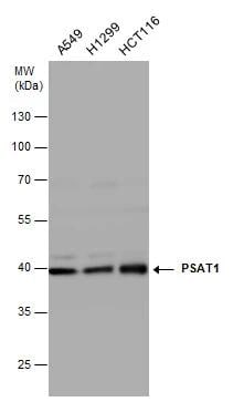 PSAT1 Antibody