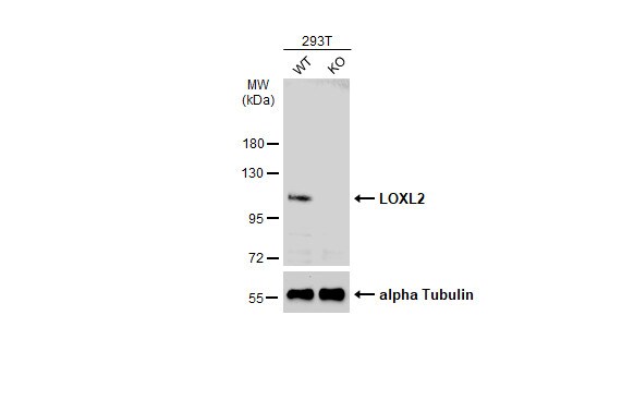 Lysyl Oxidase Homolog 2/LOXL2 Antibody