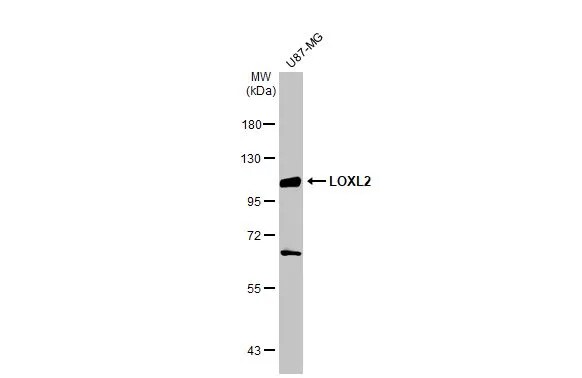 Lysyl Oxidase Homolog 2/LOXL2 Antibody