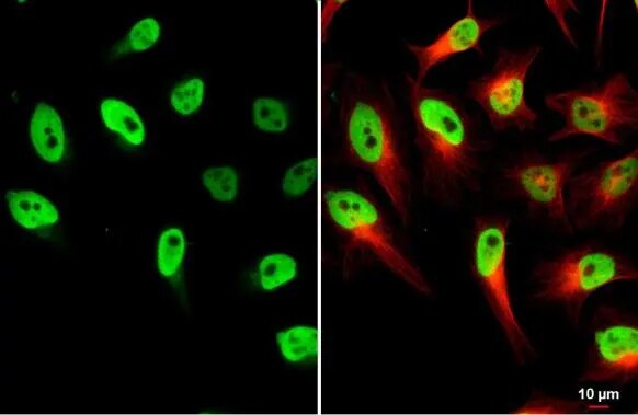 Lysyl Oxidase Homolog 2/LOXL2 Antibody