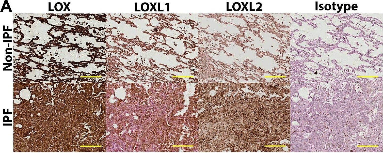 Lysyl Oxidase Homolog 2/LOXL2 Antibody - BSA Free