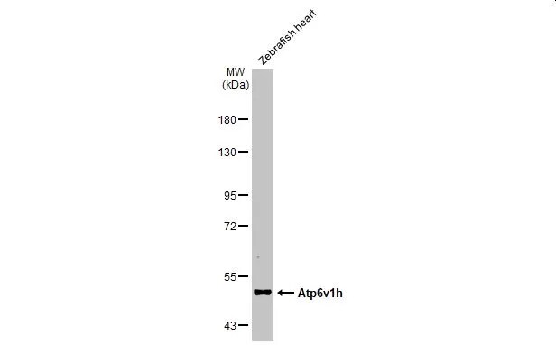 ATP6V1H Antibody