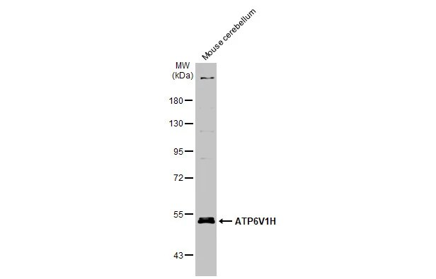 ATP6V1H Antibody