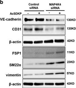 Transgelin/TAGLN/SM22 alpha Antibody - BSA Free