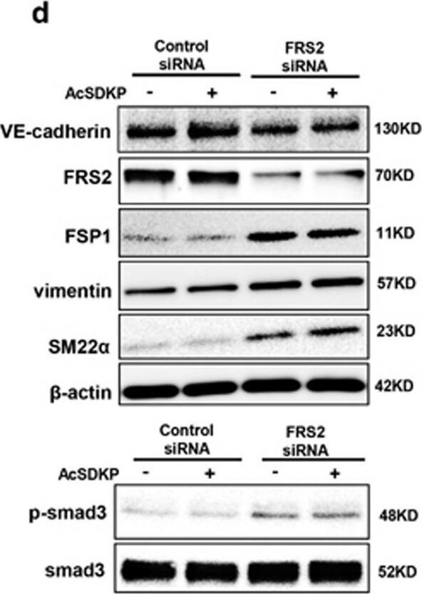 Transgelin/TAGLN/SM22 alpha Antibody - BSA Free