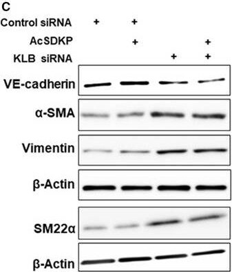 Transgelin/TAGLN/SM22 alpha Antibody - BSA Free