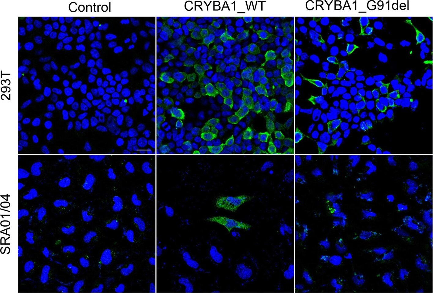 CRYBA1 Antibody