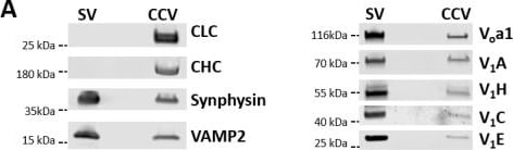 ATP6V1A Antibody