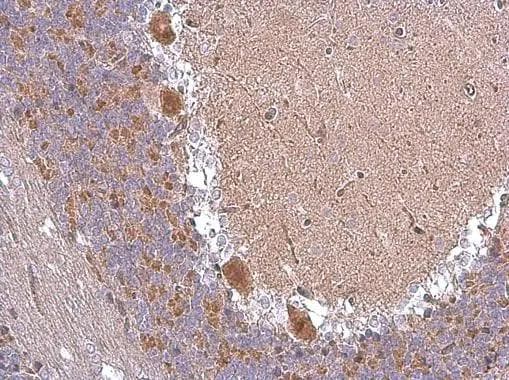 ABAT Antibody - BSA Free