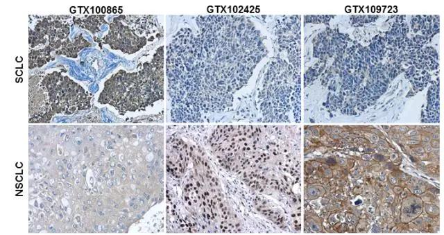 Cytokeratin 7 Antibody