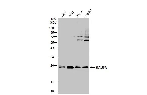 RAB6A Antibody