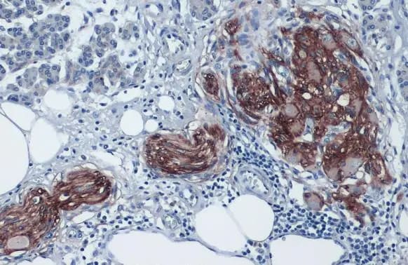 Glypican 1 Antibody