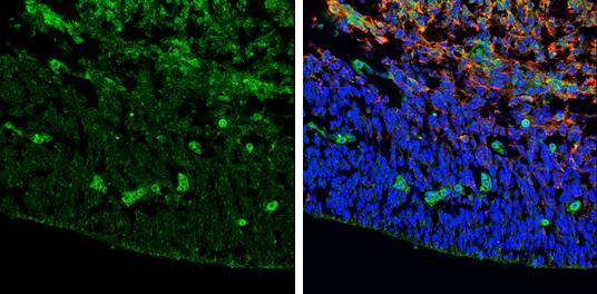 ZIC3 Antibody - BSA Free